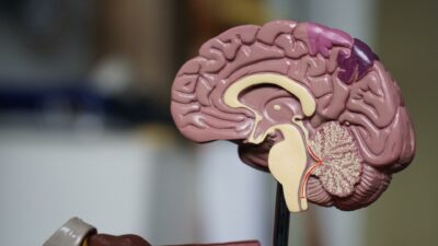 Tech Company Wants to Cure Brain Ailments with Teeny Tiny Robots