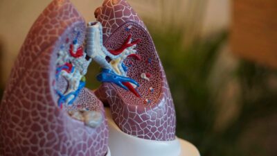 Lung Disease Breakthrough Boosts United Therapeutics — and its Rivals